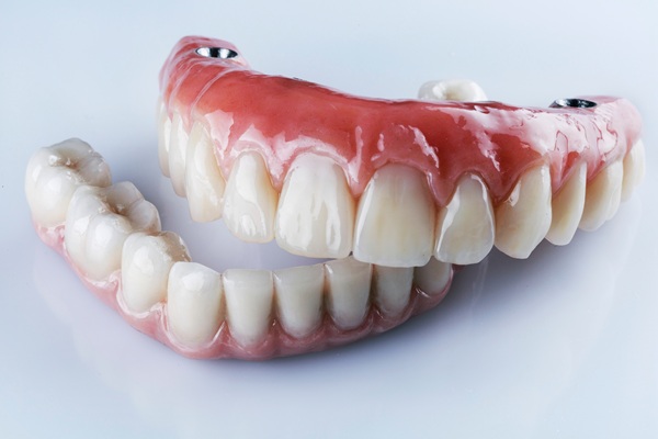 The Benefits Of Full Arch Treatment For Complete Tooth Replacement